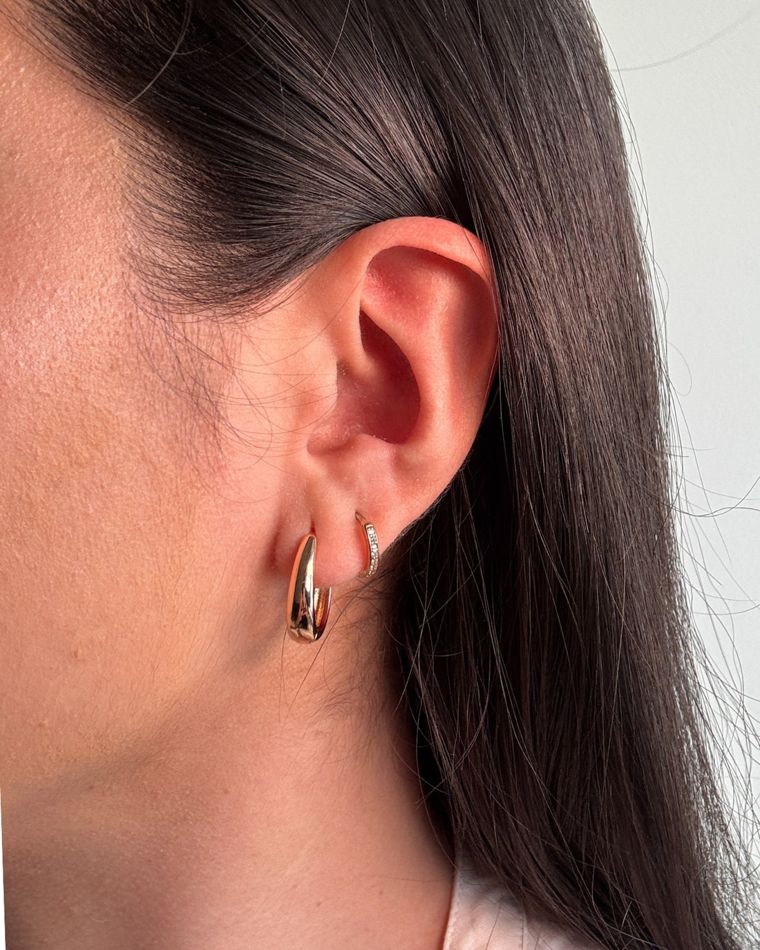 Aretes Dome